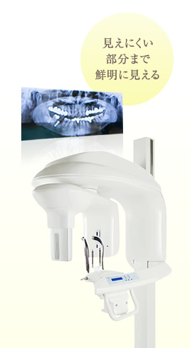 デジタル式歯科用パノラマレントゲン